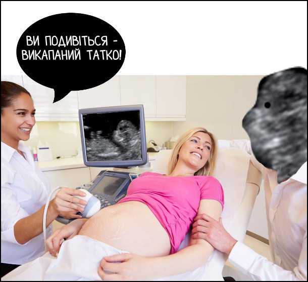 На УЗД лікар дивиться вагітну дружину і каже: - Ви подивіться - викапаний татко!
